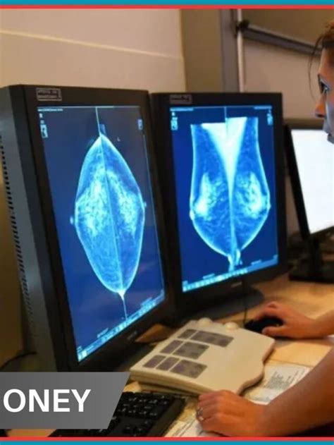 Could AI help detect more cancers from mammograms?